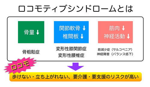 ロコモティブシンドローム